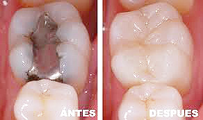 operatoria dental