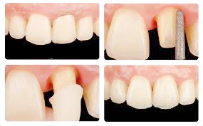 rehabilitacion oral